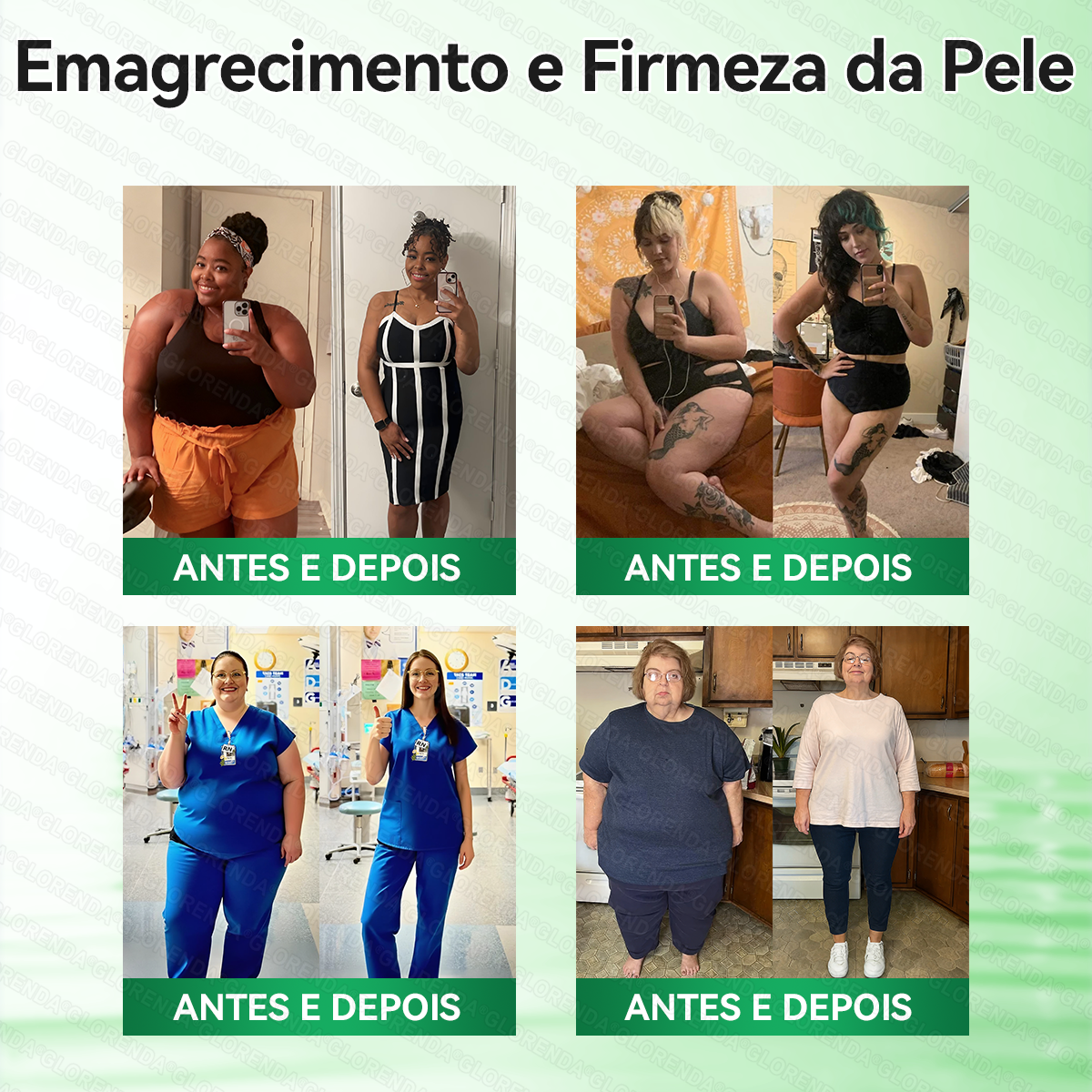 🇧🇷𝑳𝒐𝒋𝒂 𝑶𝒇𝒊𝒄𝒊𝒂𝒍 | 🩹👩‍⚕️𝐆𝐋𝗢𝗥𝗘𝗡𝗗𝑨® 𝑷𝗮𝘁𝗰𝙝 𝘼𝙫𝐚𝐧ç𝐚𝒅𝒐 𝒅𝗲 𝗠𝗶𝗰𝙧𝙤𝐚𝐠𝐮𝒍𝒉𝗮𝘀 𝟭0‑𝙚𝙢‑𝟭