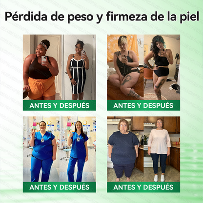 🇺🇲𝑻𝒊𝒆𝒏𝒅𝒂 𝑶𝒇𝒊𝒄𝒊𝒂𝒍 | 🍏🍏𝑮𝑳𝑶𝑹𝑬𝐍𝐃𝗔®  𝐏𝐚𝐫𝐜𝙝𝙚 𝘼𝙫𝙖𝙣𝙯𝙖𝙙𝗼 𝗱𝗲 𝗠𝗶𝗰𝗿𝗼𝒏𝒂𝒍𝒈𝒂 𝑵𝒂𝐧𝐨 𝟏0-𝙚𝙣-1(𝐒𝐨𝐥𝐨 𝐮𝐧𝐚 𝐯𝐞𝐳 𝐚𝐥 𝐝í𝐚） ✅ 𝐏𝐚𝐫𝐚 𝐥𝐚 𝐨𝐛𝐞𝐬𝐢𝐝𝐚𝐝, 🅟🅘🅔🅛 🅕🅛🅐🅒🅘🅓🅐, 𝐝𝐢𝐚𝐛𝐞𝐭𝐞𝐬, 𝐚𝐩𝐧𝐞𝐚 𝐝𝐞𝐥 𝐬𝐮𝐞ñ𝐨, 𝐩𝐫𝐨𝐛𝐥𝐞𝐦𝐚𝐬 𝐚𝐫𝐭𝐢𝐜𝐮𝐥𝐚𝐫𝐞𝐬, 𝐲 𝐦𝐮𝐜𝐡𝐨 𝐦á𝐬